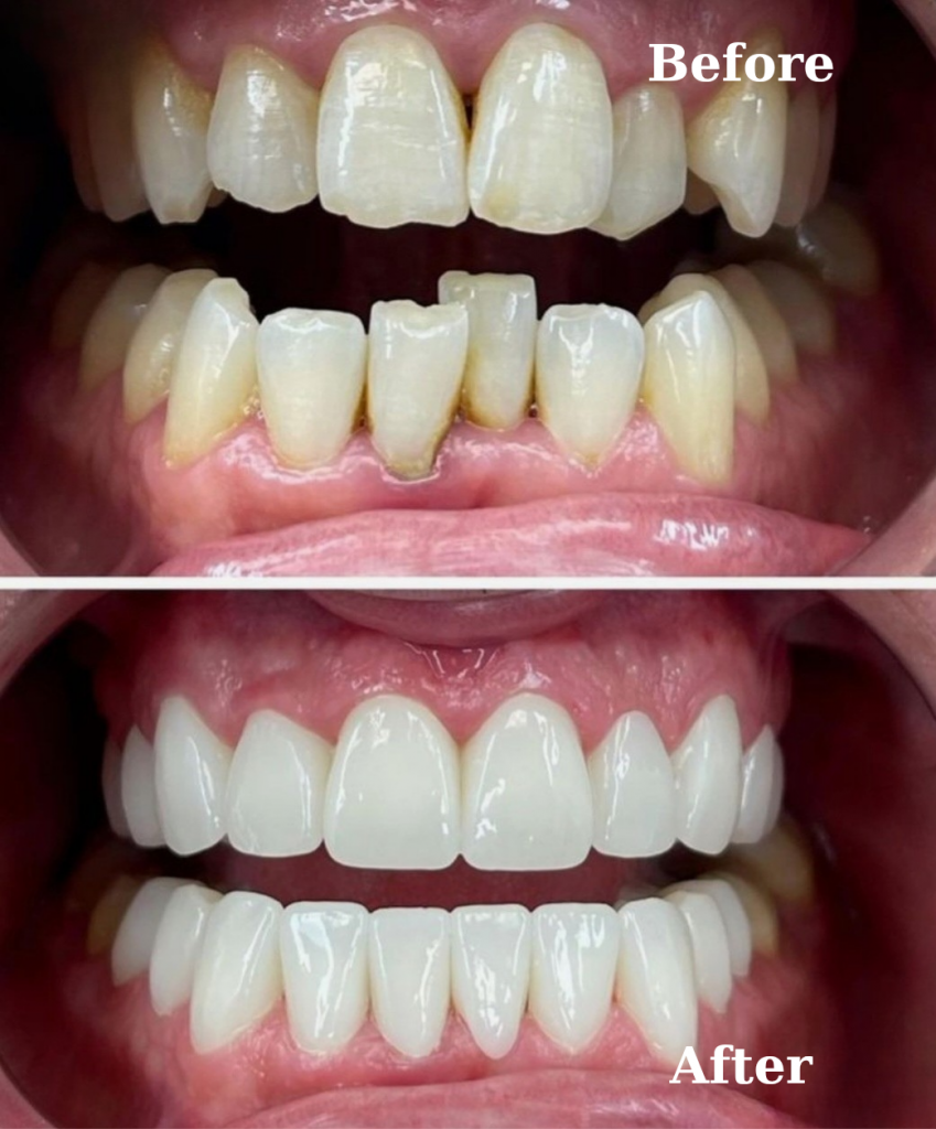 Perfeito Smile