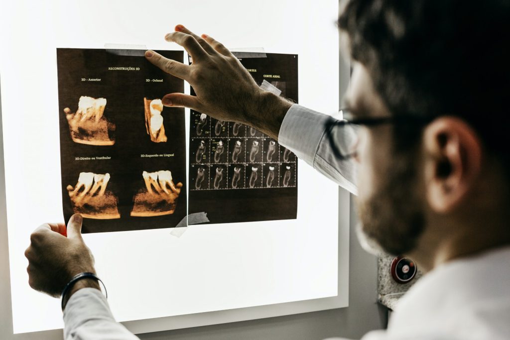 Implant dentaire en Hongrie : prix, tarifs et économies réelles en 2026 2 tarif implant dentaire