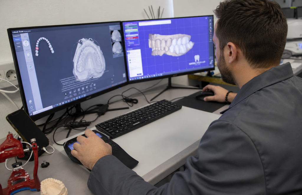 Prothésiste dentaire concevant une prothèse dentaire numérique sur un logiciel de CAO dans un laboratoire.