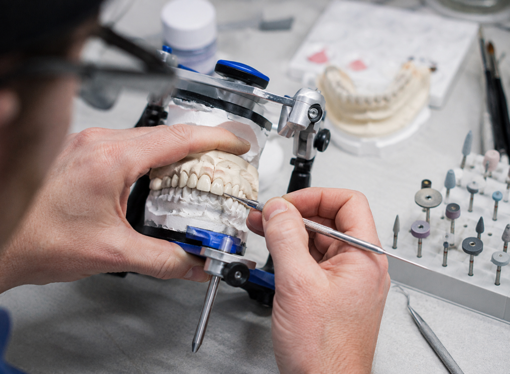 Prothésiste dentaire ajustant une prothèse sur un articulateur dans un laboratoire de prothèses dentaires.