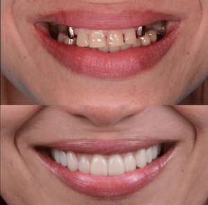clinique dentaire Turquie,dentiste turque