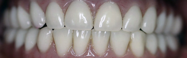 cliniques dentaires en thailande