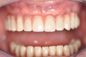 clinique dentaire Turquie,dentiste turque