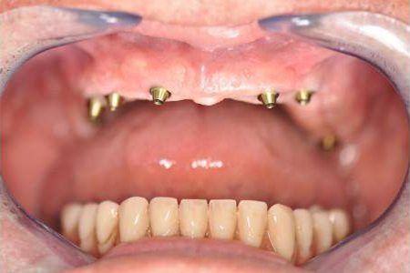 cliniques dentaires au Maroc