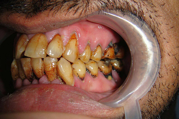 cliniques dentaires au Maroc