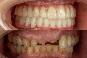 Hongrie 7 Cliniques dentaires en Hongrie,dentistes,soins dentaires