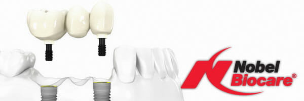 Implant dentaire en Hongrie prix : combien ça coûte vraiment en 2026 ? 2 implant dentaire hongrie prix