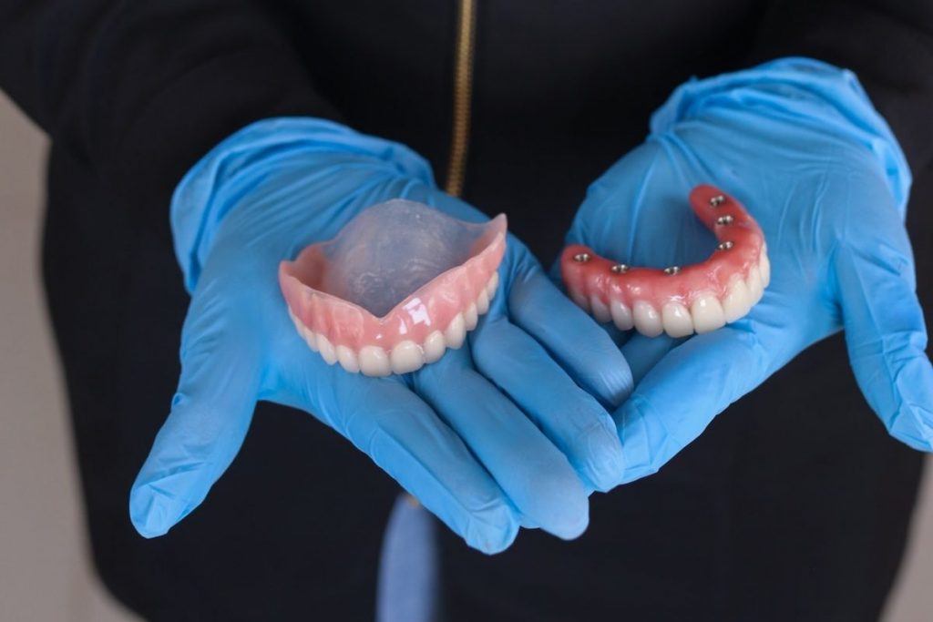 Dentier vs prothèse sur implant
