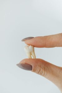 Implants dentaires,Implants dentaires à l'étranger