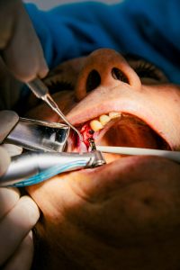 Hongrie 9 Cliniques dentaires en Hongrie,dentistes,soins dentaires