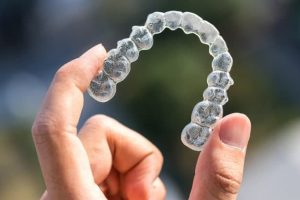 Prothèse ivisalign