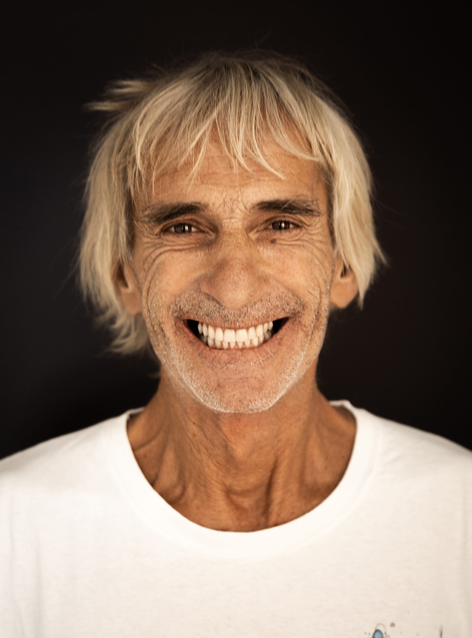 Prix implant dentaire mâchoire complète Portugal