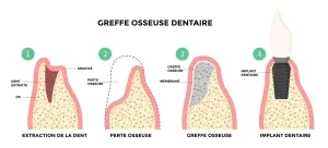Cliniques dentaires au Portugal,soins dentaires