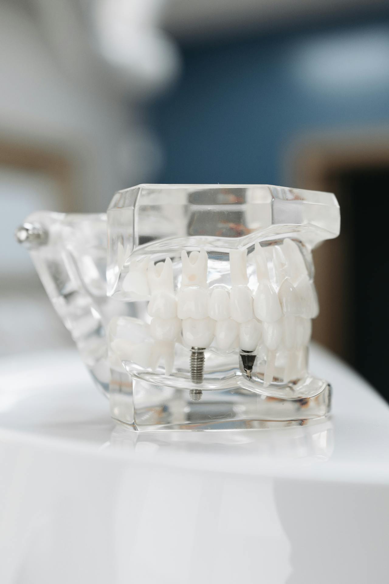 Implant dentaire Hongrie