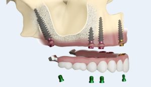 Cliniques dentaires au Portugal,soins dentaires