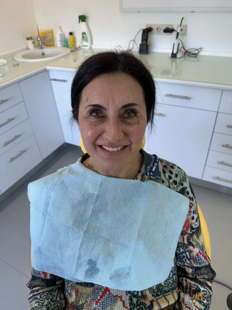 Comment refaire toutes ses dents quand on n’a pas les moyens ? 4 refaire sa dentition complète pas cher