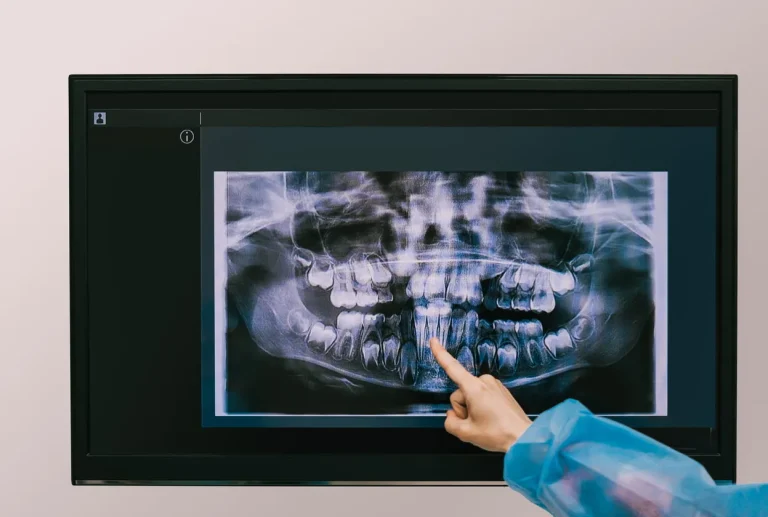 Contre-indications implants dentaires