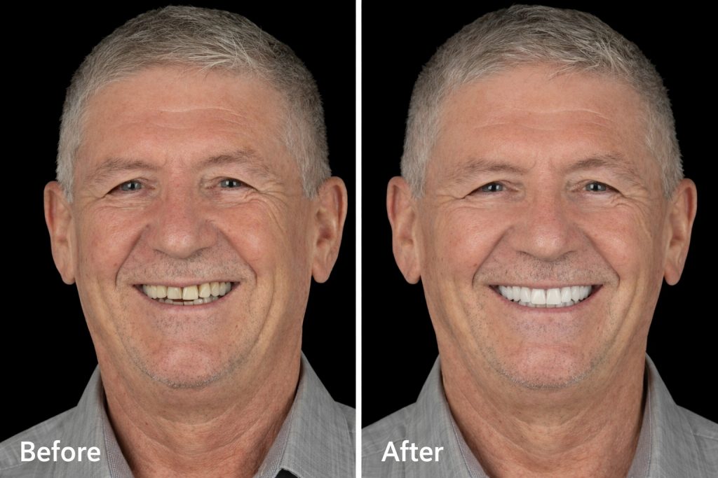 All-on-6 pas cher à Tirana