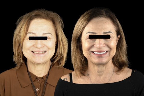 Comparaison soins dentaires étrangers