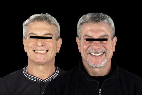 Photos de soins dentaires