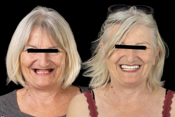 Témoignages visuels patients dentaires